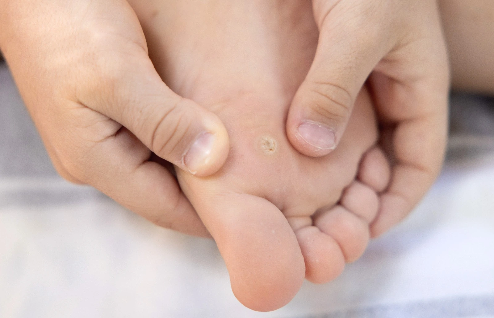 Descripción Quiropidia